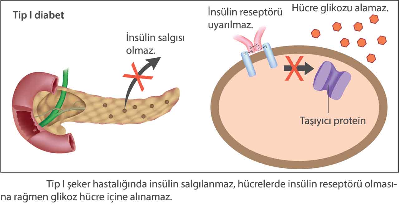 tib-1-diyabet.jpg